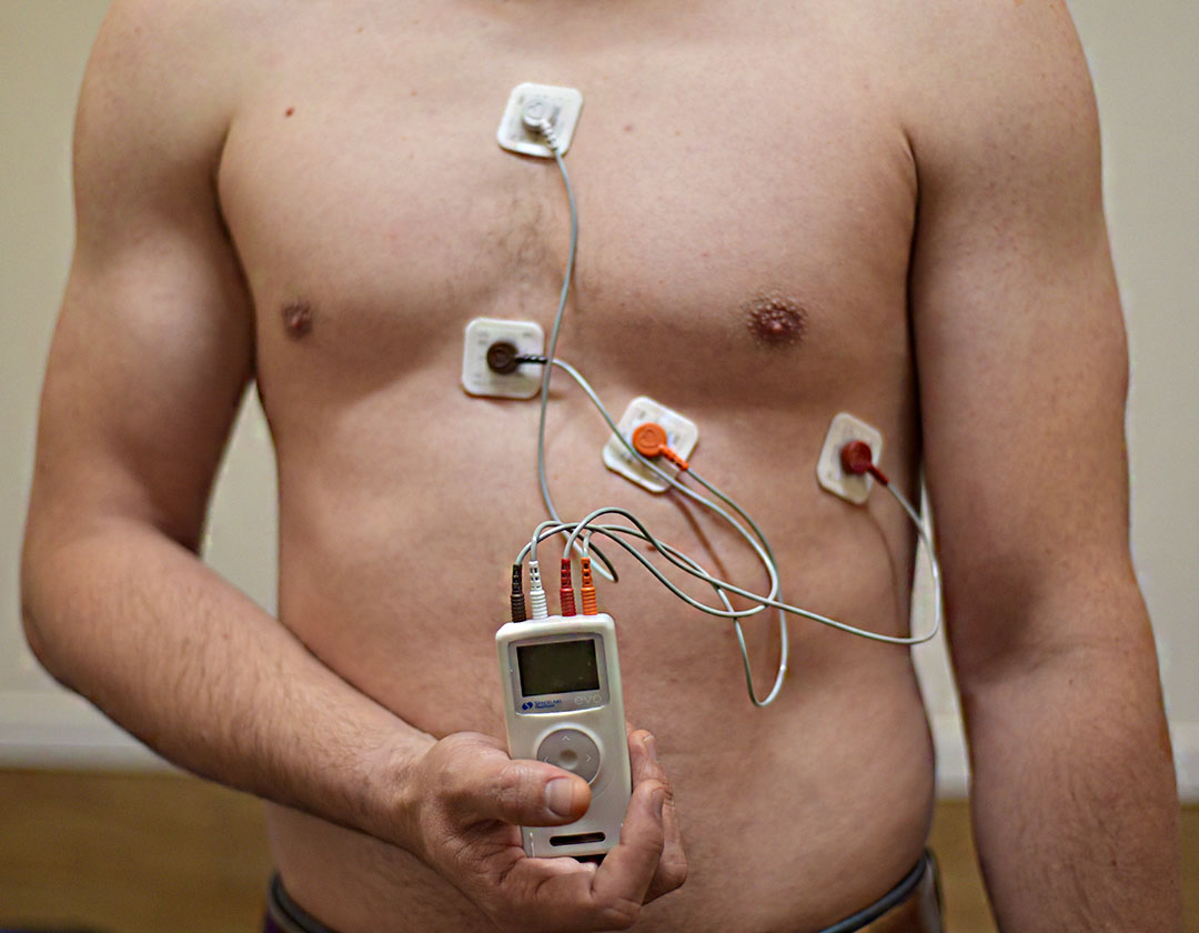 Holter de presión arterial: ¿Qué es y cuándo se indica?